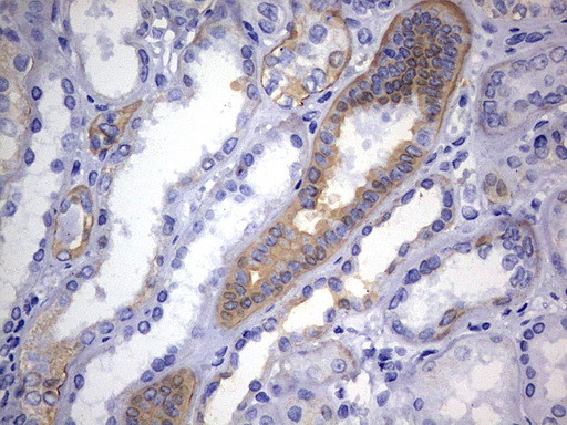 KRT24 Antibody in Immunohistochemistry (Paraffin) (IHC (P))