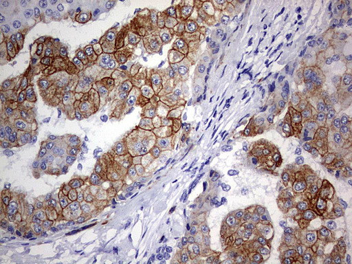 KRT24 Antibody in Immunohistochemistry (Paraffin) (IHC (P))