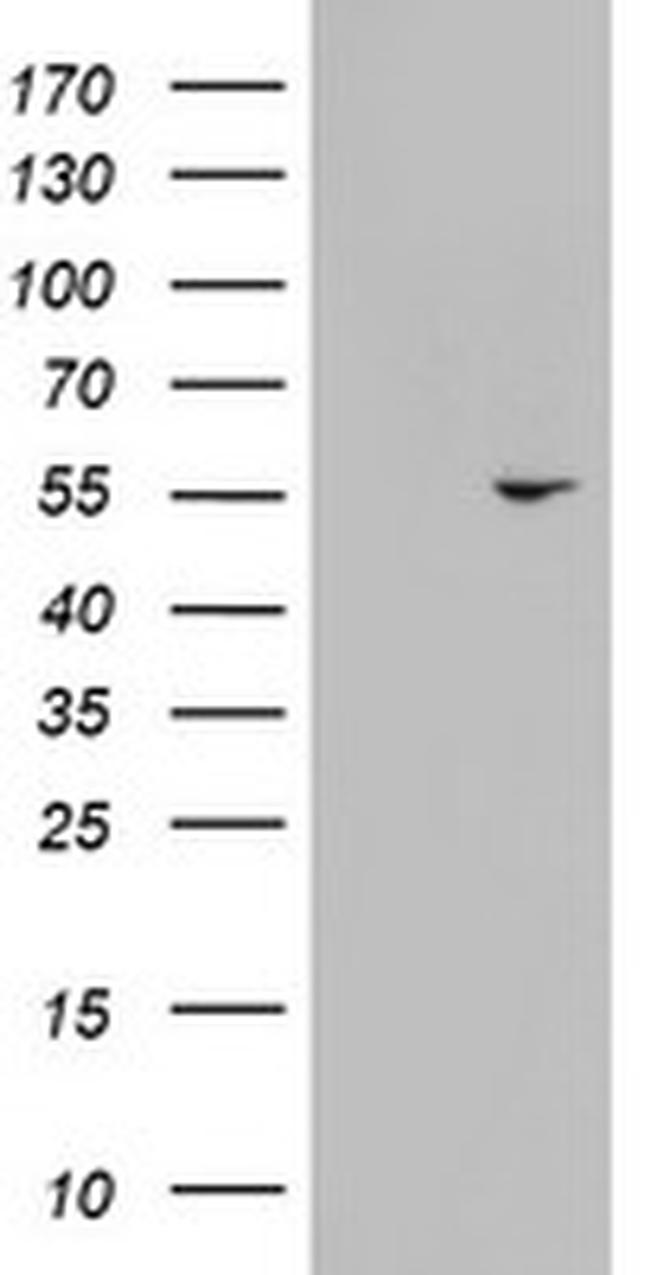 KRT24 Antibody in Western Blot (WB)