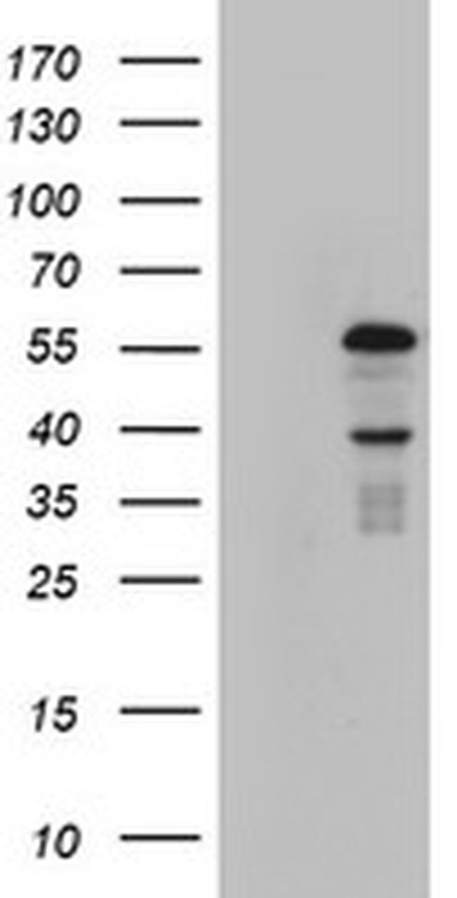 KRT24 Antibody in Western Blot (WB)