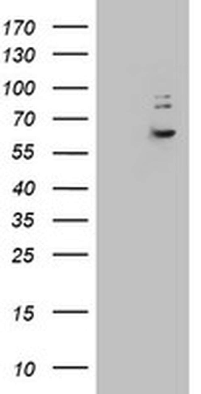 KRT24 Antibody in Western Blot (WB)