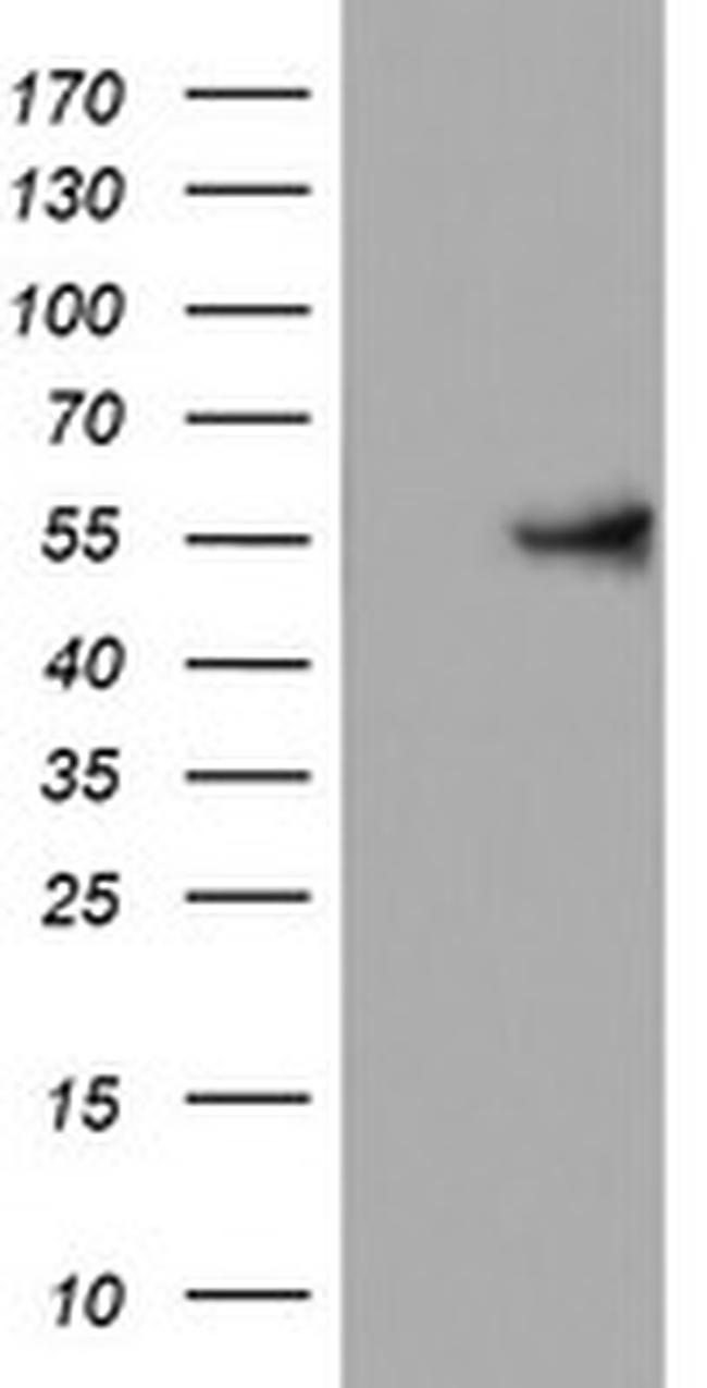 KRT24 Antibody in Western Blot (WB)