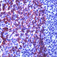 Cytokeratin 5 Antibody in Immunohistochemistry (Paraffin) (IHC (P))