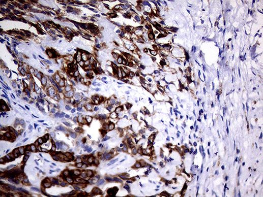 KRT5 Antibody in Immunohistochemistry (Paraffin) (IHC (P))