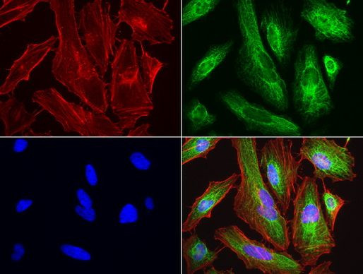 KRT7 Antibody in Immunocytochemistry (ICC/IF)