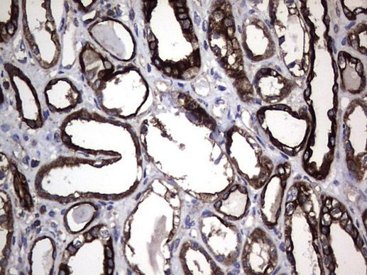 KRT7 Antibody in Immunohistochemistry (Paraffin) (IHC (P))