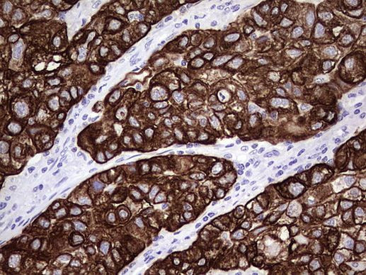 KRT7 Antibody in Immunohistochemistry (Paraffin) (IHC (P))