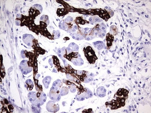 KRT7 Antibody in Immunohistochemistry (Paraffin) (IHC (P))