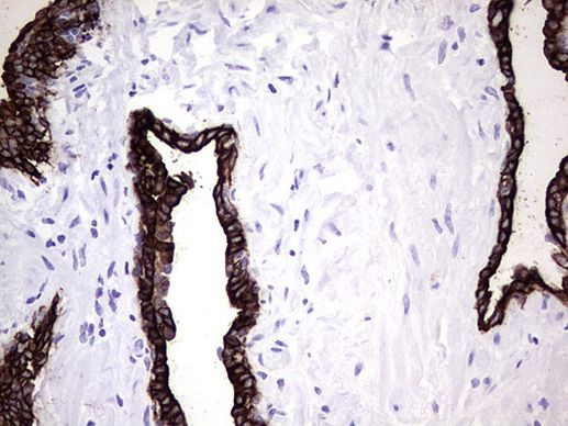 KRT7 Antibody in Immunohistochemistry (Paraffin) (IHC (P))