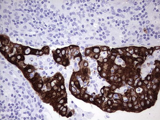 KRT7 Antibody in Immunohistochemistry (Paraffin) (IHC (P))