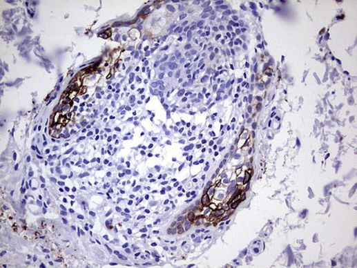 KRT7 Antibody in Immunohistochemistry (Paraffin) (IHC (P))