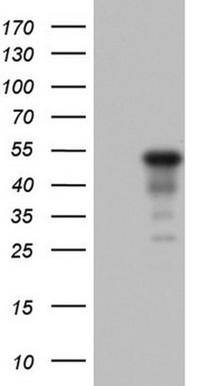 KRT7 Antibody in Western Blot (WB)