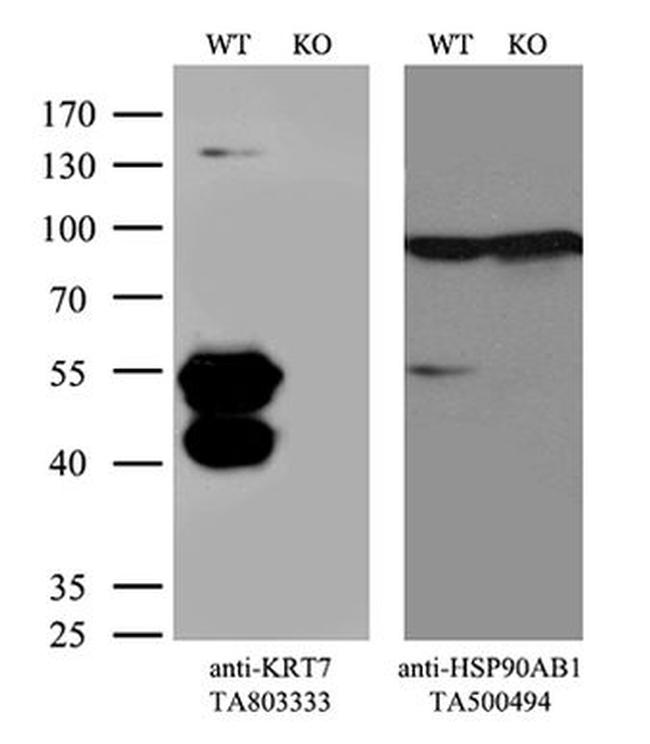 KRT7 Antibody in Western Blot (WB)