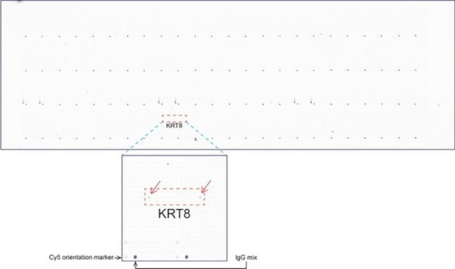 KRT8 Antibody in Peptide array (ARRAY)