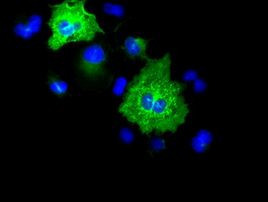 KRT8 Antibody in Immunocytochemistry (ICC/IF)