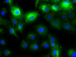 KRT8 Antibody in Immunocytochemistry (ICC/IF)