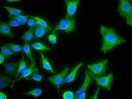 KRT8 Antibody in Immunocytochemistry (ICC/IF)