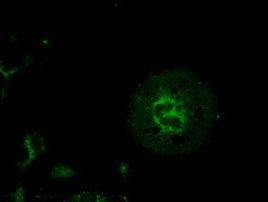 KRT8 Antibody in Immunocytochemistry (ICC/IF)