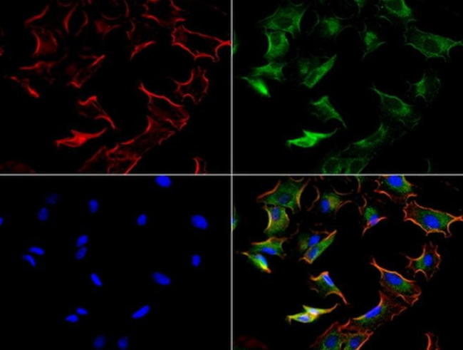 KRT8 Antibody in Immunocytochemistry (ICC/IF)