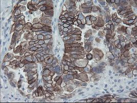 KRT8 Antibody in Immunohistochemistry (Paraffin) (IHC (P))