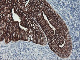 KRT8 Antibody in Immunohistochemistry (Paraffin) (IHC (P))