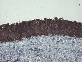 KRT8 Antibody in Immunohistochemistry (Paraffin) (IHC (P))