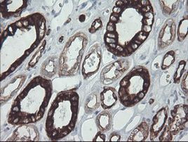 KRT8 Antibody in Immunohistochemistry (Paraffin) (IHC (P))