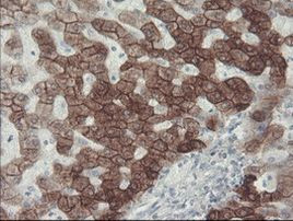 KRT8 Antibody in Immunohistochemistry (Paraffin) (IHC (P))