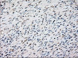 KRT8 Antibody in Immunohistochemistry (Paraffin) (IHC (P))