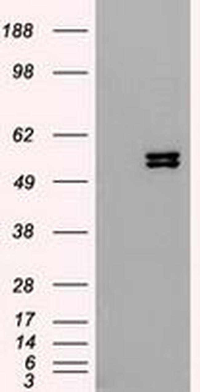 KRT8 Antibody in Western Blot (WB)