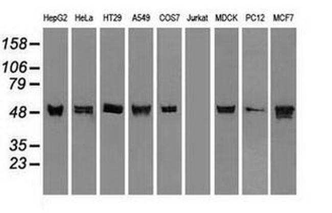 KRT8 Antibody in Western Blot (WB)