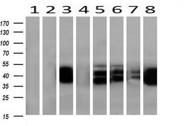 KRT8 Antibody in Western Blot (WB)