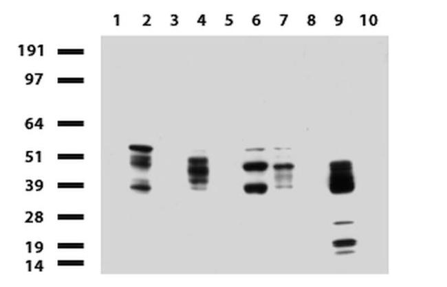 KRT8 Antibody in Western Blot (WB)