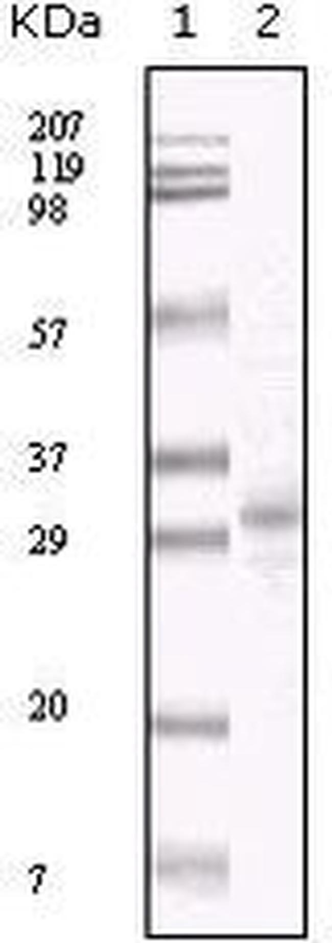 KSHV ORF26 Antibody in Western Blot (WB)