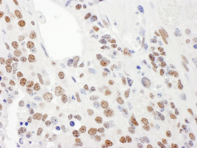 KSRP Antibody in Immunohistochemistry (IHC)