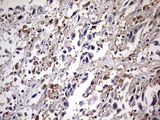 KYNU Antibody in Immunohistochemistry (Paraffin) (IHC (P))