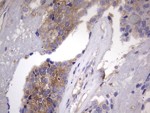 KYNU Antibody in Immunohistochemistry (Paraffin) (IHC (P))