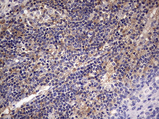 KYNU Antibody in Immunohistochemistry (Paraffin) (IHC (P))