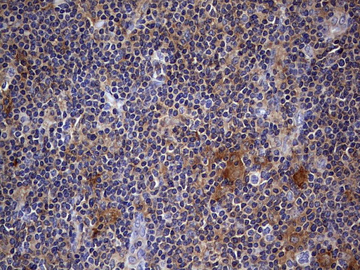 KYNU Antibody in Immunohistochemistry (Paraffin) (IHC (P))