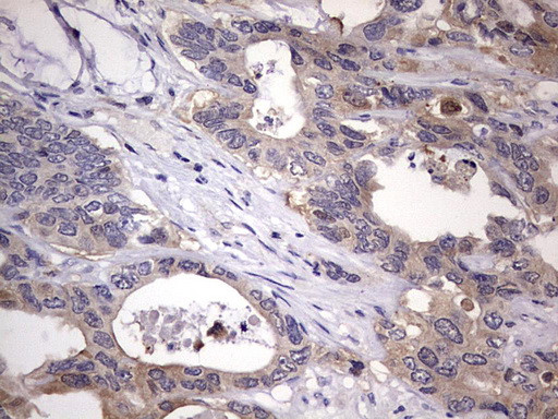 KYNU Antibody in Immunohistochemistry (Paraffin) (IHC (P))