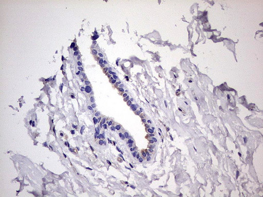 KYNU Antibody in Immunohistochemistry (Paraffin) (IHC (P))