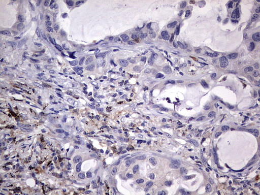 KYNU Antibody in Immunohistochemistry (Paraffin) (IHC (P))