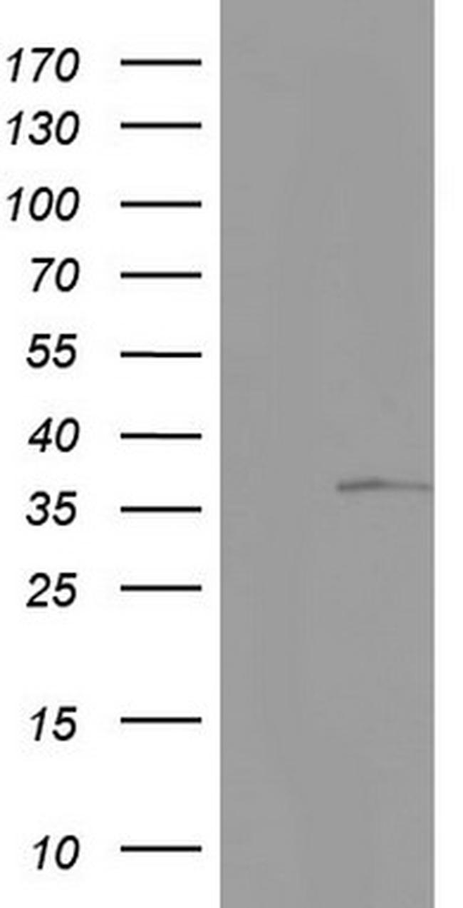 KYNU Antibody in Western Blot (WB)