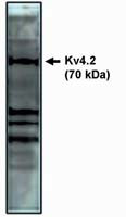 KV4.2 (KCND2) Antibody in Western Blot (WB)