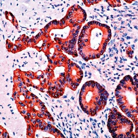 Cytokeratin 19 Antibody in Immunohistochemistry (Paraffin) (IHC (P))