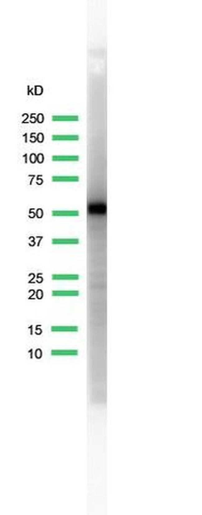 Cytokeratin 5 Antibody in Western Blot (WB)