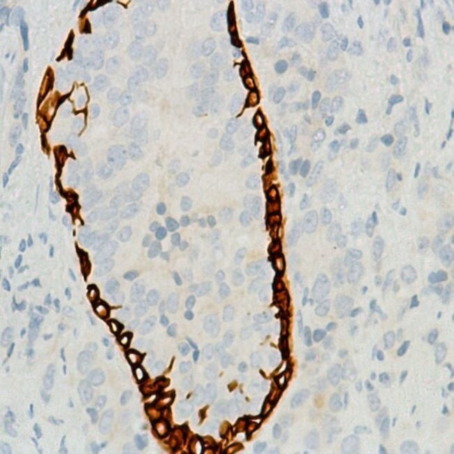 Cytokeratin 6 Antibody in Immunohistochemistry (Paraffin) (IHC (P))