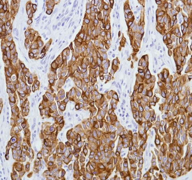 Cytokeratin 8 Antibody in Immunohistochemistry (Paraffin) (IHC (P))