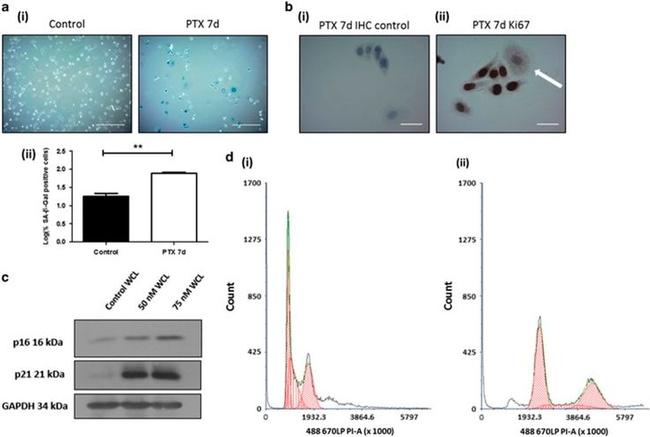 Ki-67 Antibody in Immunohistochemistry (IHC)