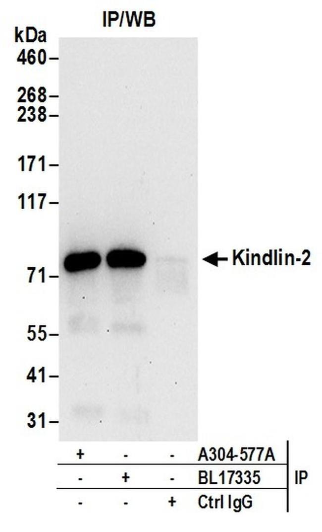 Kindlin-2 Antibody in Western Blot (WB)